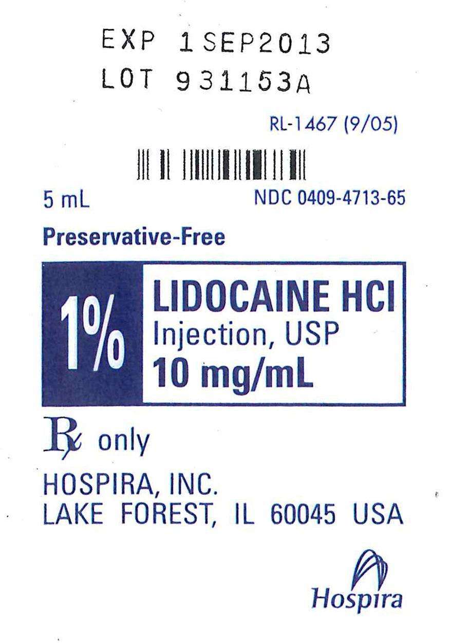 15950-20 CONTINUOUS EPIDURAL 18G HUSTEAD